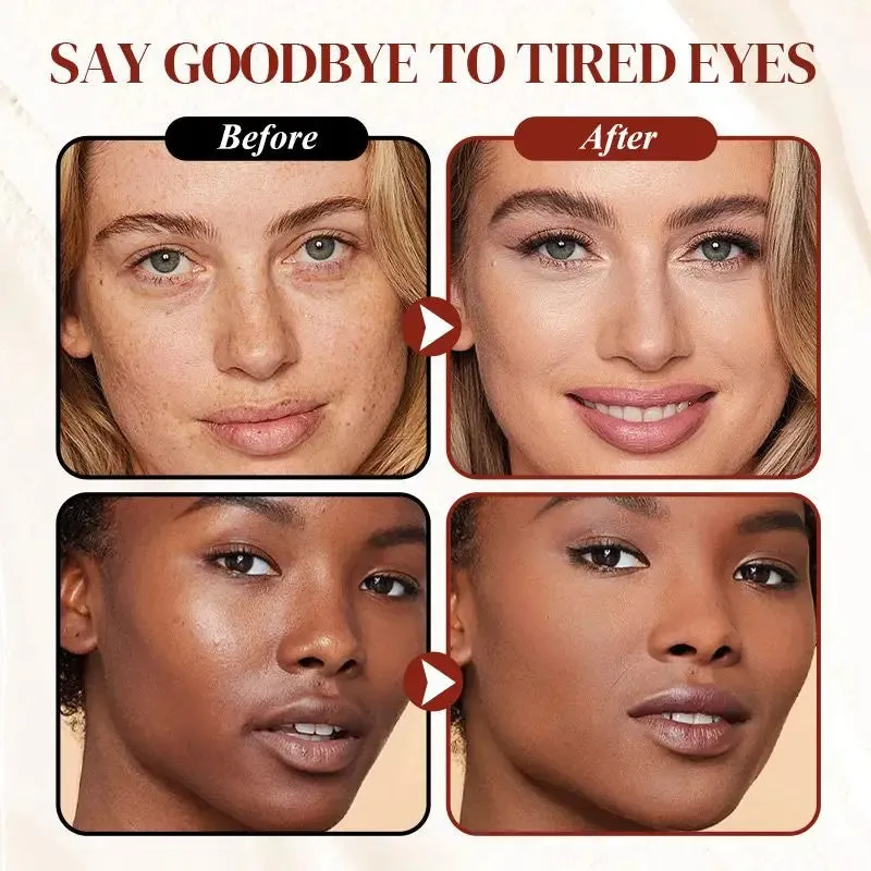(1   1 Free) Bright Eyes Concealer