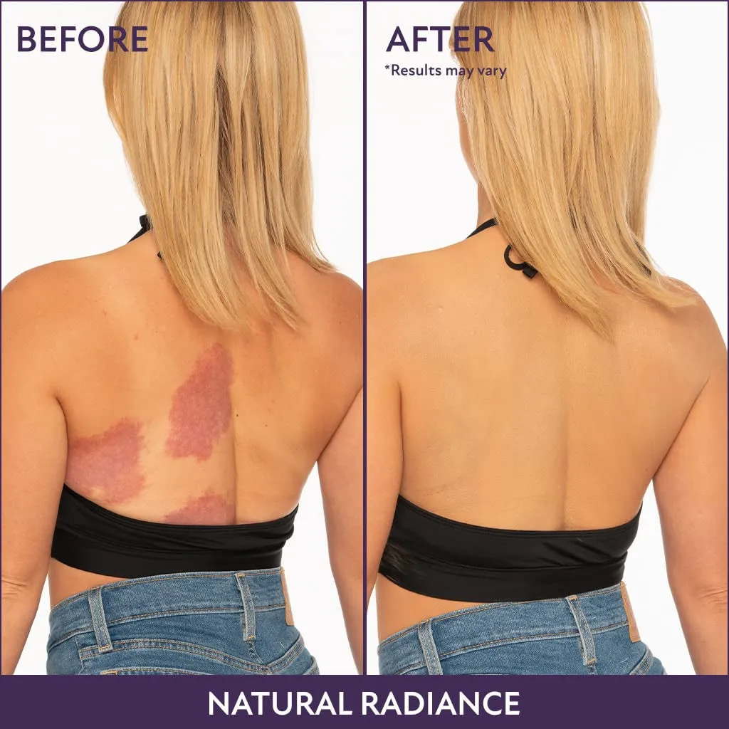 Body Coverage Perfector – Waterproof Leg & Body Makeup - Tattoo Cover up Makeup - 3.5 Oz (Natural Radiance)