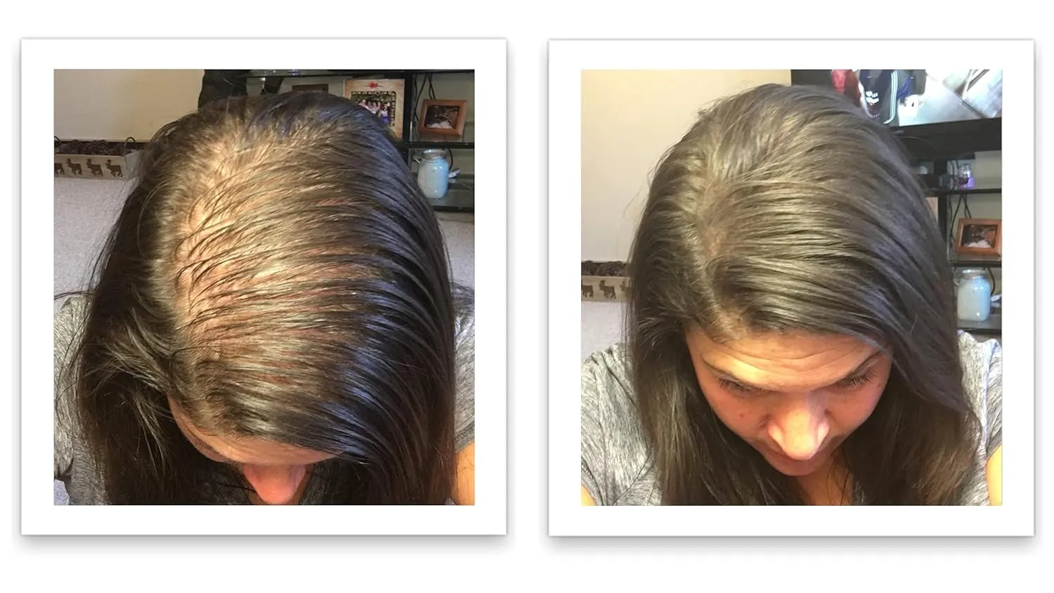 Hair Loss Concealer, 90-Day Supply, Dark Brown