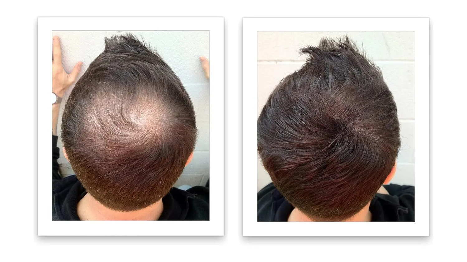Hair Loss Concealer, 90-Day Supply, Dark Brown