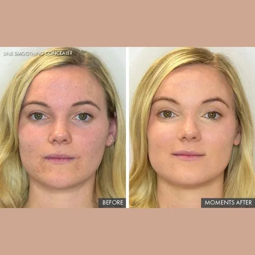 Line Smoothing Concealer by Genie Beauty (Ships in 2-3 Weeks)