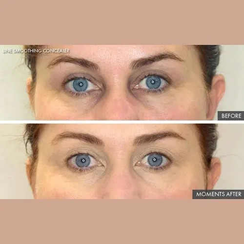 Line Smoothing Concealer by Genie Beauty (Ships in 2-3 Weeks)