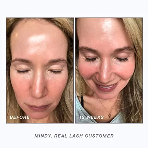 NULASTIN Lash Serum - Follicle Fortifying Conditioner | Eyelash Enhancers Treatment with Elastin — Promotes Appearance of Fuller, Thicker Looking Lashes, Safe for Extensions