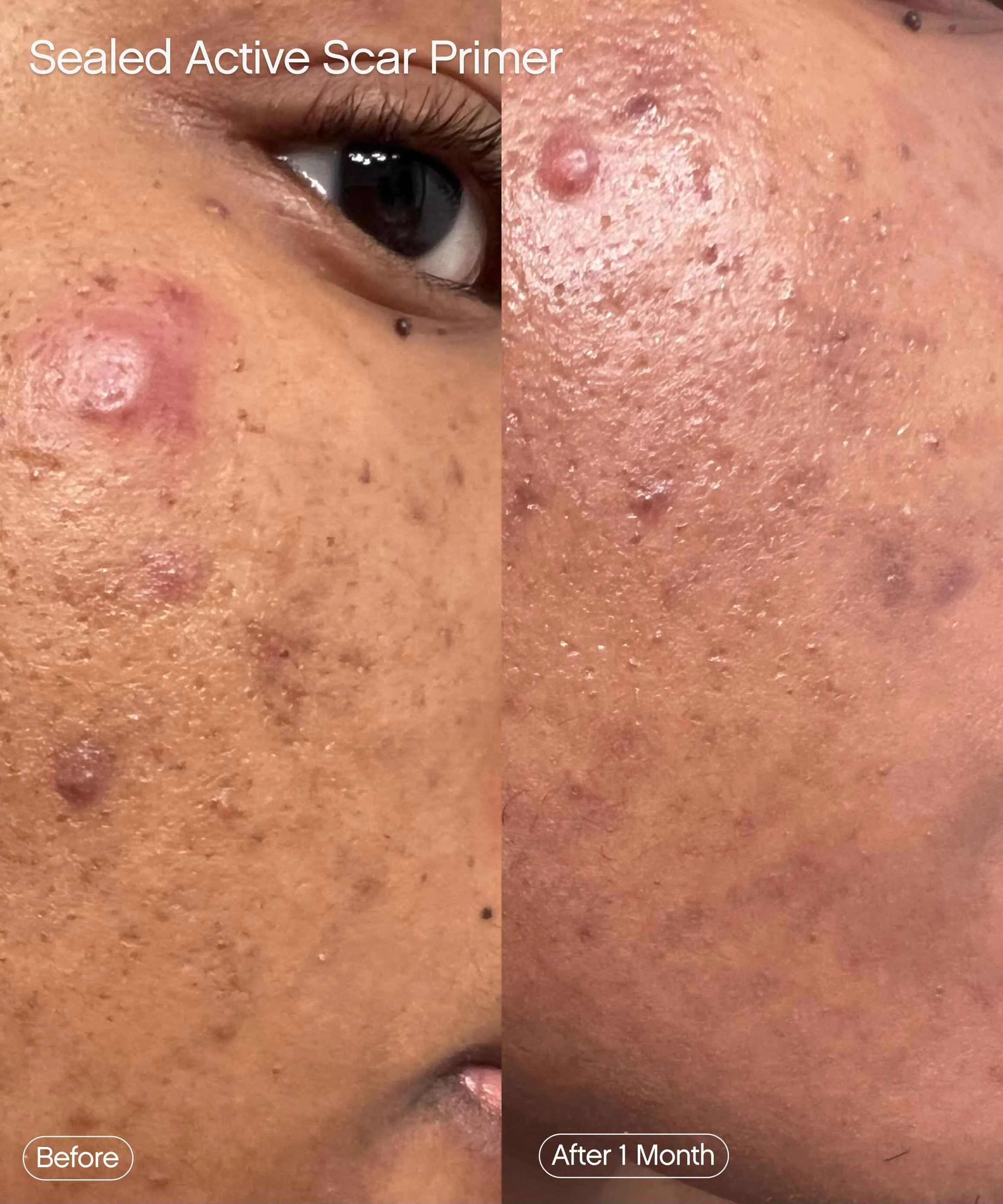 Sealed Scar Filling Primer