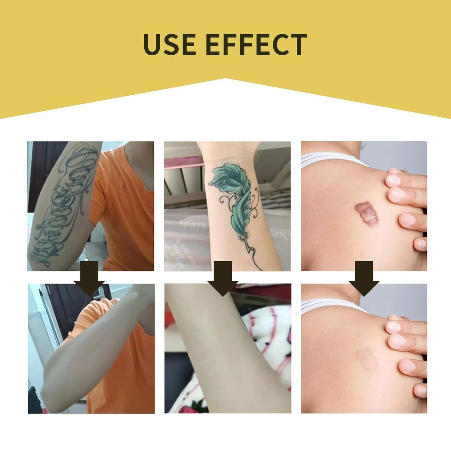Tattoo Cover up Patch, Tattoo Cover up Tape, Ultra Thin Patch for Tattoo Scar and Birthmarks, Invisible Waterproof Skin Tone Concealer Sticker for Covering up Scars Tattoos, 6 Pcs - Light Skin
