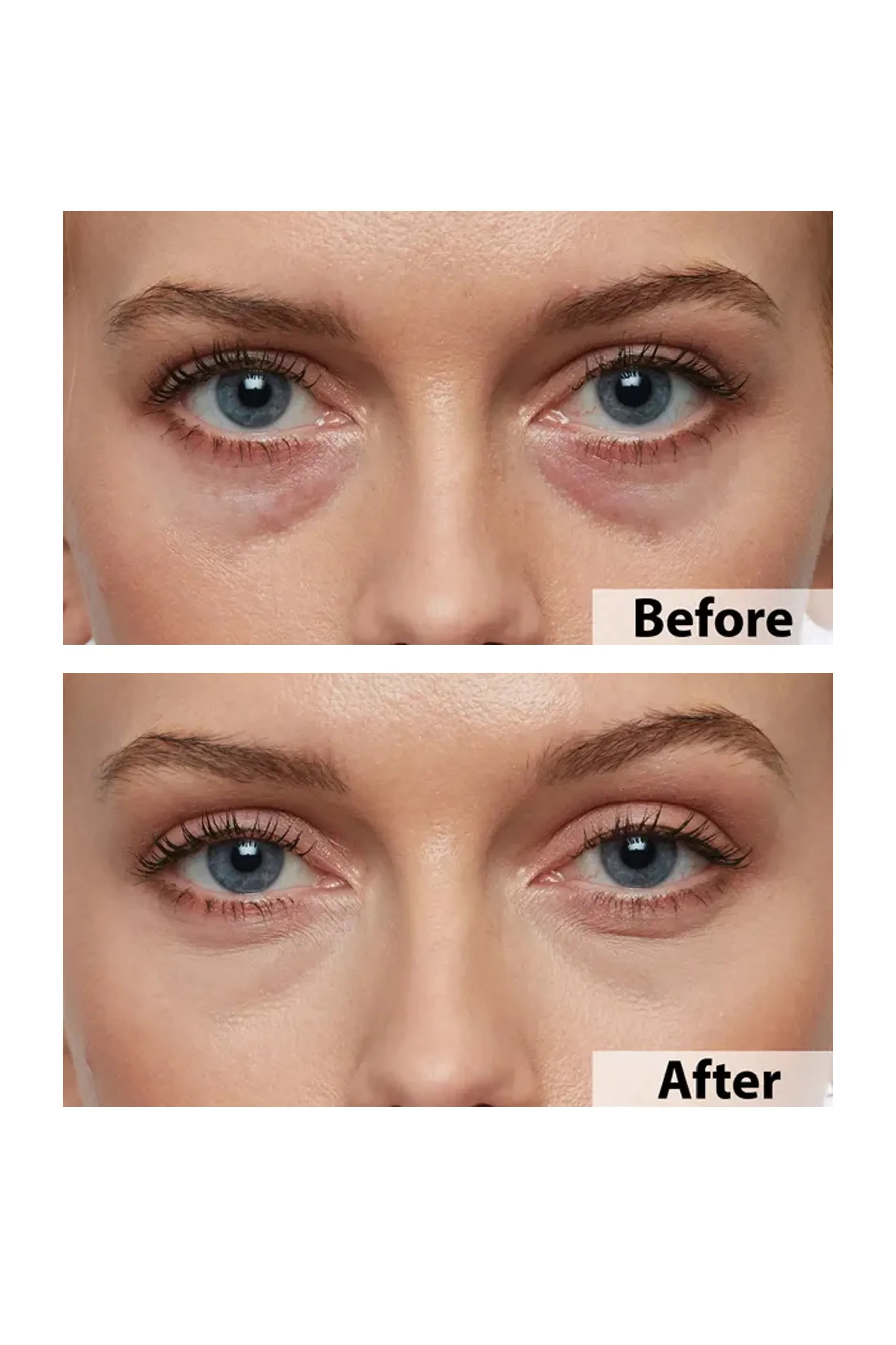 Thin Lizzy Age-Reverse Under Eye Concealer Duchess 7ml